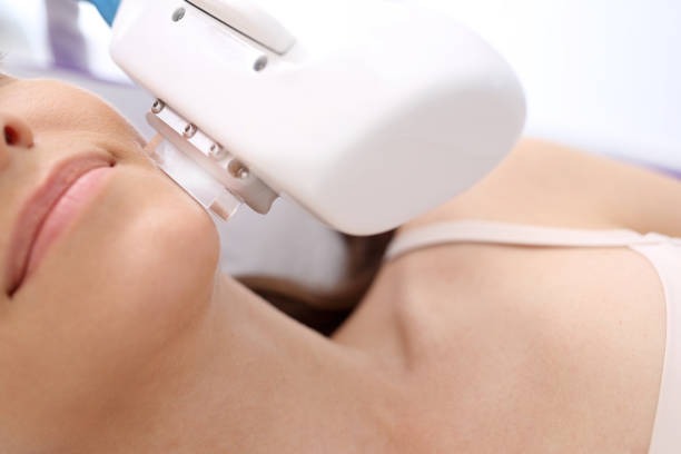 Why More People Choose Laser Treatments for Hair Reduction